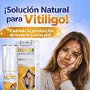 Spray de ervas Evenora – Solução natural para vitiligo