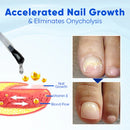 Sérum para Crescimento e Reparação de Unhas