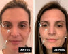 Sérum antirrugas para os olhos