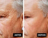 Sérum antirrugas para os olhos